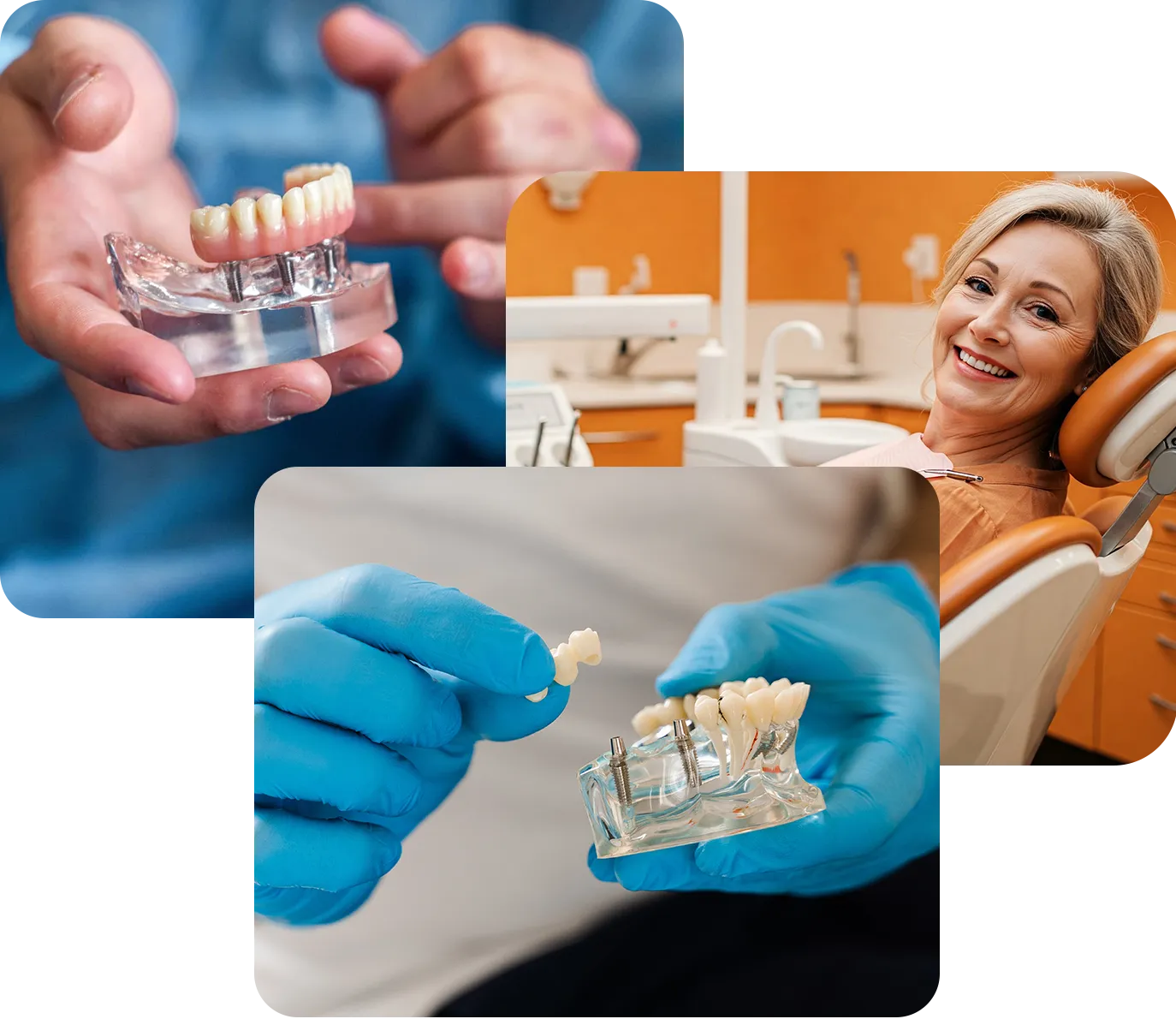 Freesmile implantologia copia